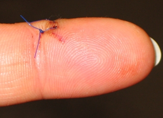 finger 3